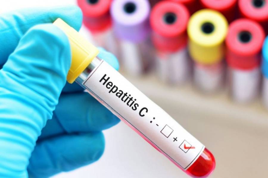 Prevención, vacunas y testeos, las claves contra las hepatitis virales