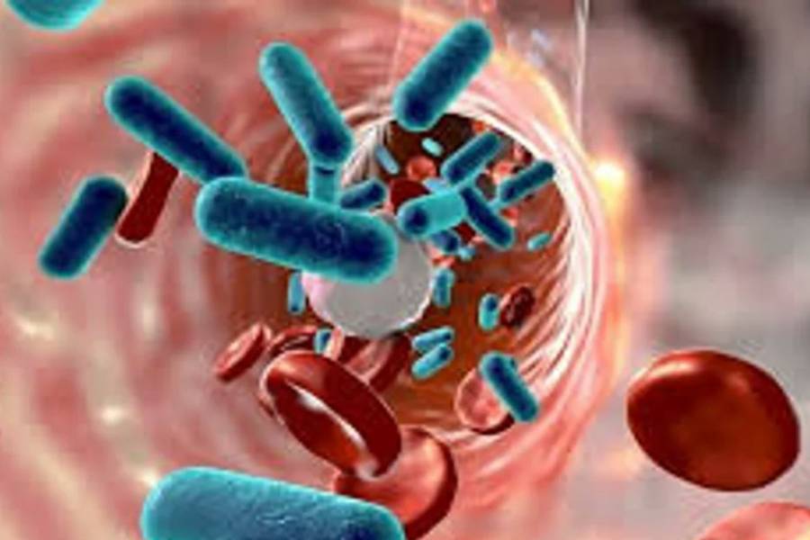 En Argentina se registran unos 300 casos al año de Síndrome Urémico Hemolítico