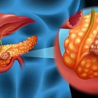 Cáncer de páncreas: científicos españoles lograron eliminarlo en un estudio con ratones