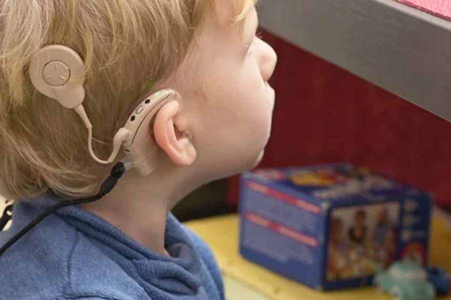 Día Mundial del Implante Coclear: qué es y por qué se conmemora este miércoles