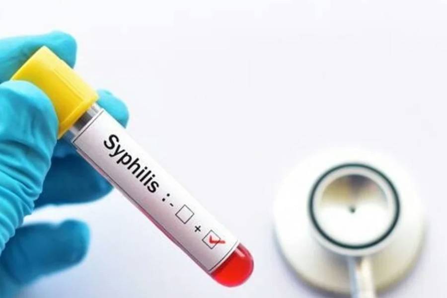 Alerta sífilis: en 2025 hubo más de 46.000 casos